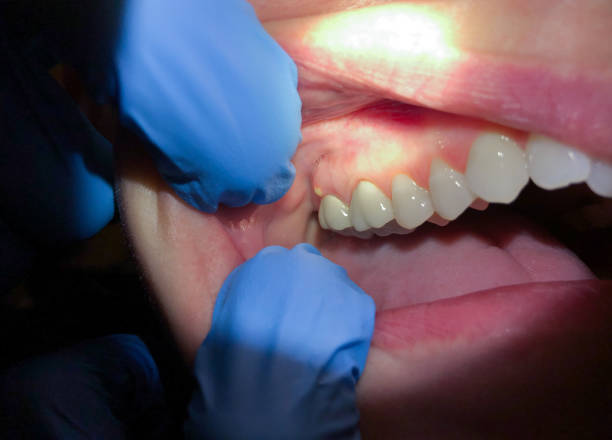 Best Emergency Dentist for Special Needs Patients in Saranap, CA