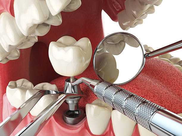 Best Weekend Emergency Dentist in Saranap, CA